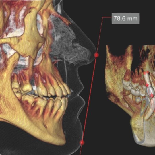3D snímok s CT